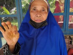 Dikunjungi Bupati, Rohimah Terharu